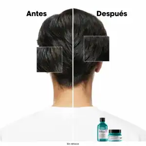 L'ORÉAL PROFESSIONNEL SHAMPOO ANTI GRASA L'ORÉAL PROFESSIONEL SCALP 300ML - Imagen 3