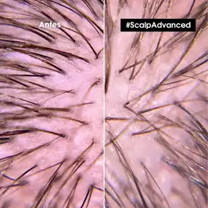 L'ORÉAL PROFESSIONNELSHAMPOO ANTI IRRITACIÓN SCALP 300ML - Imagen 3