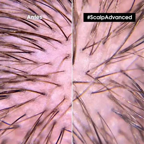 L'ORÉAL PROFESSIONNELSHAMPOO ANTI IRRITACIÓN SCALP 300ML - en Ultra Panamá