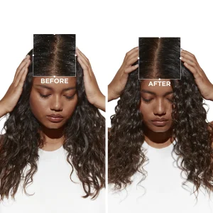 KÉRASTASE SHAMPOO ANTICASPA CABELLO SECO SYMBIOSE 250ML - Imagen 3