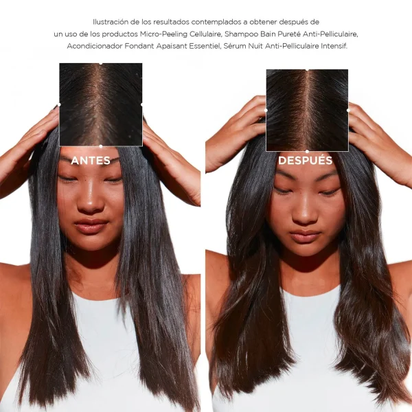 KÉRASTASE SHAMPOO ANTICASPA CABELLO GRASO SYMBIOSE 250ML - en Ultra Panamá