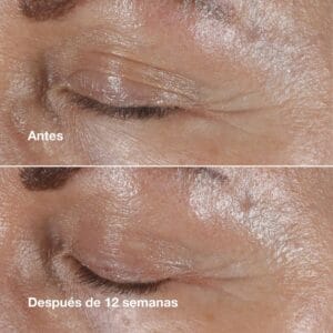 Clinique Crema Contorno de ojos Smart Clinical Repair™ Antiarrugas 15ml - Imagen 4