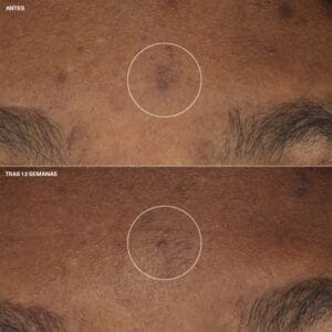 Clinique Crema Hidratante Even Better Clinical™ Antimanchas 50ml - Imagen 3