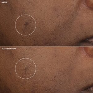 Clinique Crema Hidratante Even Better Clinical™ Antimanchas 50ml - Imagen 4