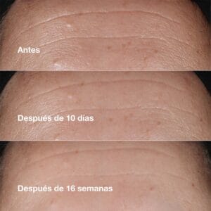 Clinique Suero Hidratante Smart Clinical Repair ™ Antiarrugas 10ml - Imagen 4